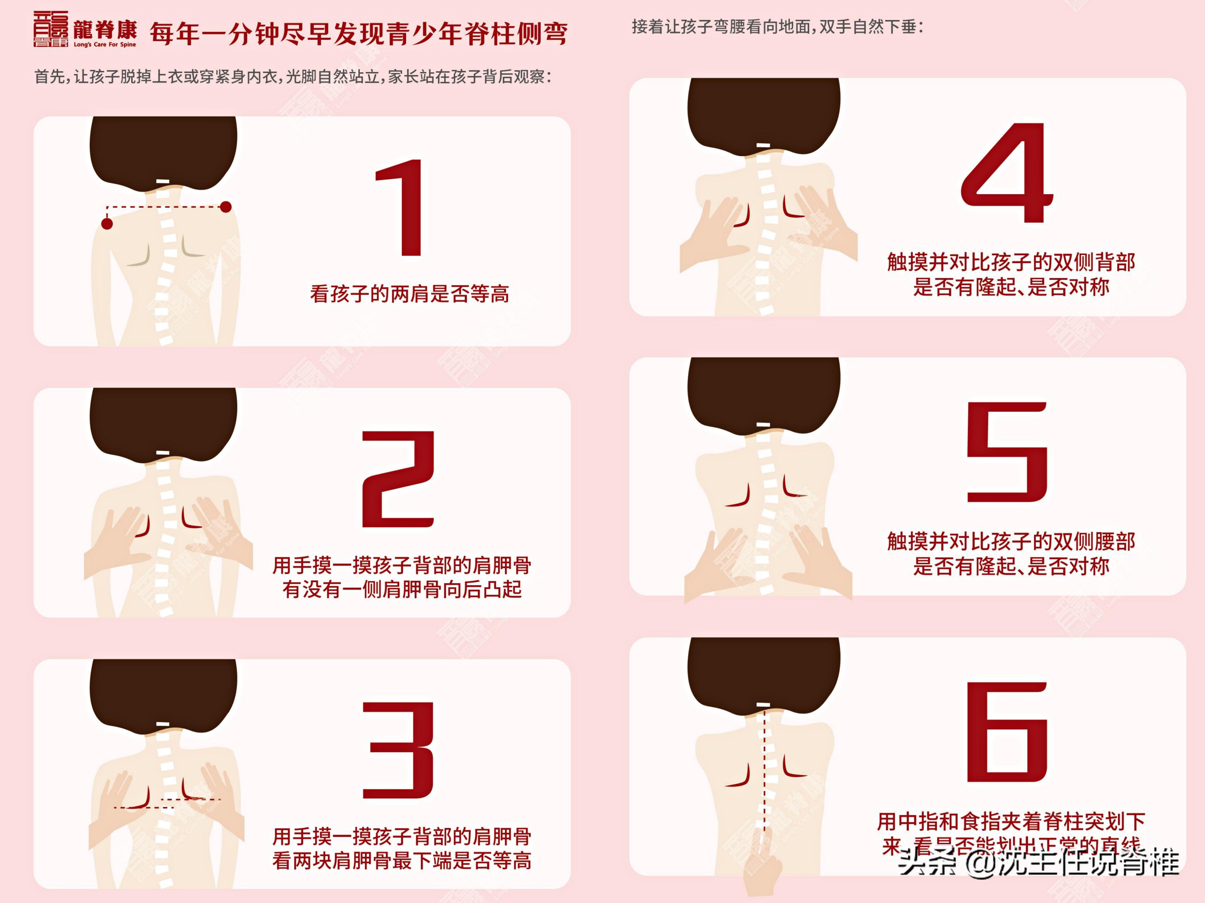 脊柱侧弯已纳入学生体检是怎么回事，关于入学体检脊柱侧弯能通过吗?的新消息。