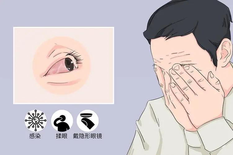 ##男子新婚夜忘摘隐形眼镜眼球变白