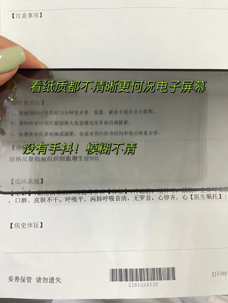 医生提醒长时间用防窥膜会视疲劳,防窥膜累眼睛吗