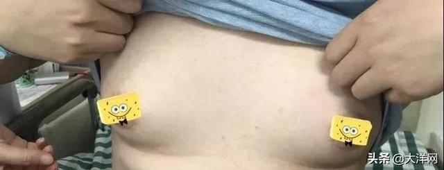 小伙胸部增大挤出乳汁怎么回事？25岁小伙的难言之隐