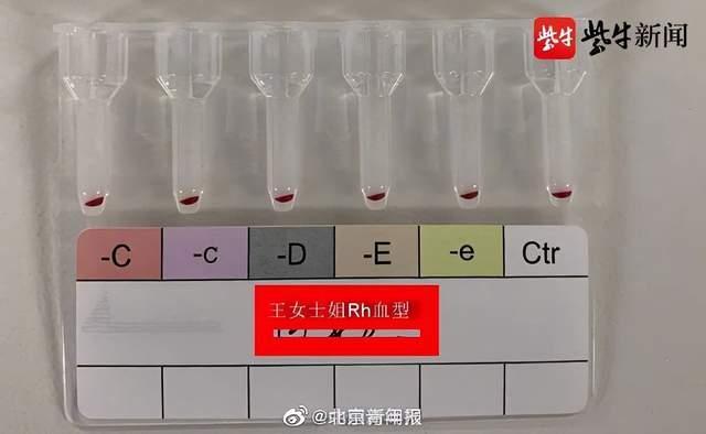 江苏发现2例全球罕见黄金血型 黄金血型全球不足50例可以给所有人输血