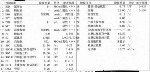 教你看懂化验单 尿常规能检查出什么