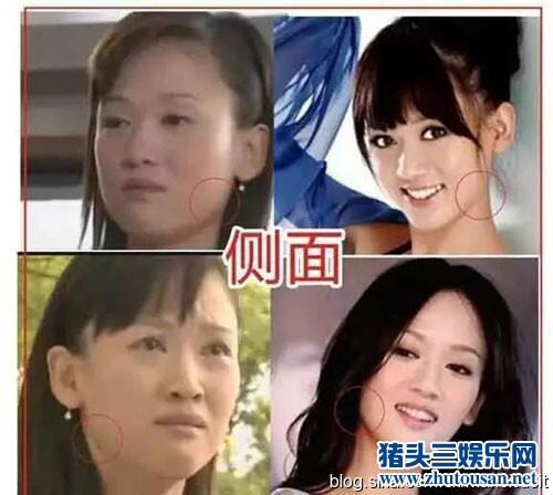 深扒陈乔恩10年整容之路蜕变成女神（图）