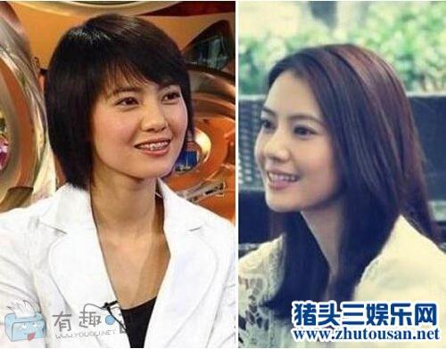 Angelababy小学旧照曝光 力证纯天然变美靠的是牙套？