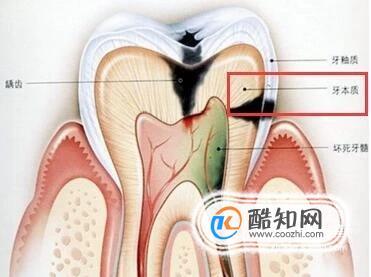 牙齿的结构图及名称图片