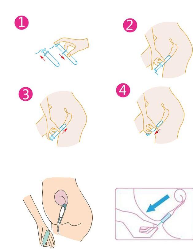 月经棉条使用图解 内置卫生棉条的用法